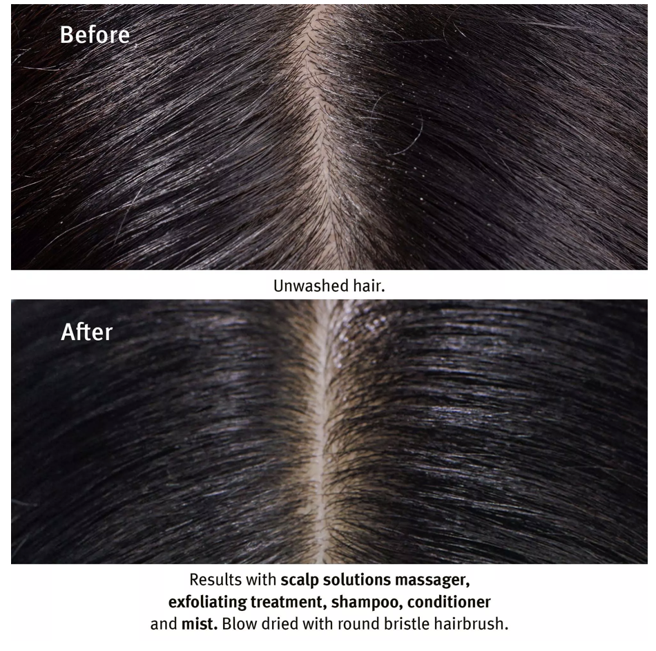 Scalp Solutions Overnight Recovery Serum