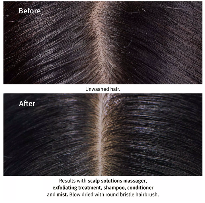 Scalp Solutions Overnight Recovery Serum